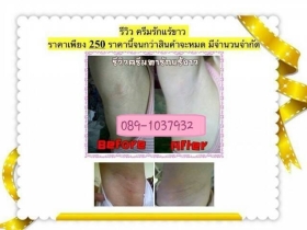 ครีมเร่งผิวขาวอย่างไวแค่ 7 วัน